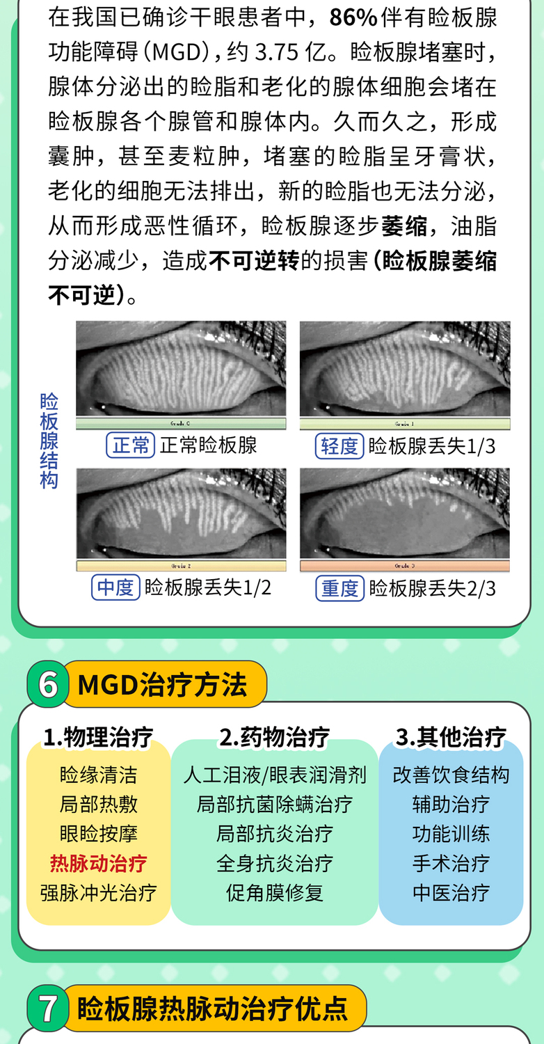 20251205干眼门诊新技术---MGD治疗“睑板腺热脉动治疗”(公众号文章图)更新版3.jpg